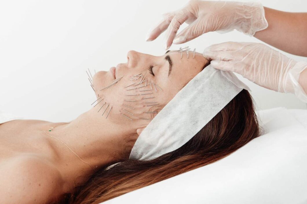 Kobieta podczas profesjonalnego zabiegu needle shaping